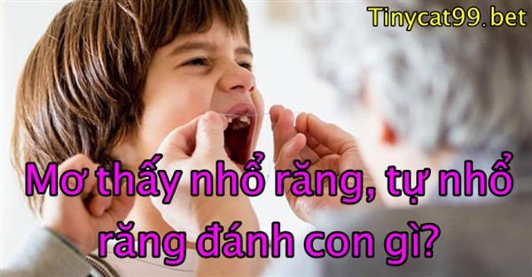 Mơ Thấy Nhổ Răng, Tự Nhổ Răng Đánh Con Gì? Giải Mã Điềm Xui Hay Hên? 