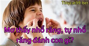 Mơ Thấy Nhổ Răng, Tự Nhổ Răng Đánh Con Gì? Giải Mã Điềm Xui Hay Hên? 